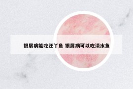 銀屑病能吃汪丫魚 銀屑病可以吃淡水魚