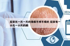 后背長一片一片的像癬不疼不癢的 后背有一小片一小片的癬