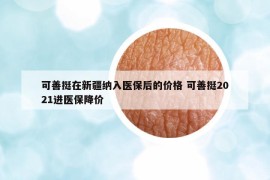 可善挺在新疆納入醫(yī)保后的價(jià)格 可善挺2021進(jìn)醫(yī)保降價(jià)