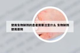 使用生物制劑的患者需要注意什么 生物制劑使用原則