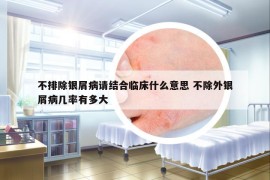 不排除銀屑病請結(jié)合臨床什么意思 不除外銀屑病幾率有多大
