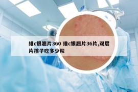 維c銀翹片360 維c銀翹片36片,雙層片孩子吃多少粒