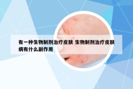 有一種生物制劑治療皮膚 生物制劑治療皮膚病有什么副作用