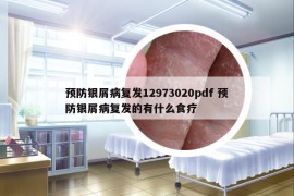 預(yù)防銀屑病復(fù)發(fā)12973020pdf 預(yù)防銀屑病復(fù)發(fā)的有什么食療