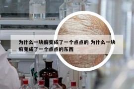 為什么一塊癬變成了一個(gè)點(diǎn)點(diǎn)的 為什么一塊癬變成了一個(gè)點(diǎn)點(diǎn)的東西