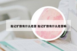 胎記擴(kuò)散有什么危害 胎記擴(kuò)散有什么危害嘛