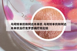 烏司奴單抗和阿達(dá)木單抗 烏司奴單抗和阿達(dá)木單抗治療克羅恩病療效比較