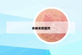 赤峰皮膚醫(yī)院