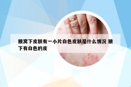 腋窩下皮膚有一小片白色皮膚是什么情況 腋下有白色的皮