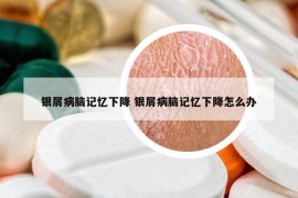 銀屑病腦記憶下降 銀屑病腦記憶下降怎么辦