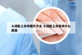 小孩臉上白塊圖片大全 小孩臉上白色塊什么原因