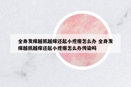 全身發(fā)癢越抓越癢還起小疙瘩怎么辦 全身發(fā)癢越抓越癢還起小疙瘩怎么辦傳染嗎