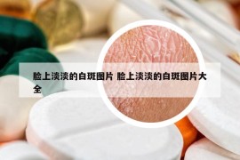 臉上淡淡的白斑圖片 臉上淡淡的白斑圖片大全
