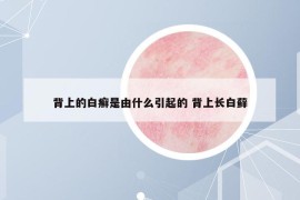 背上的白癬是由什么引起的 背上長白蘚