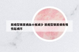 膿皰型銀屑病血小板減少 膿皰型銀屑病有慢性起病不