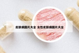 皮膚病圖片大全 女性皮膚病圖片大全