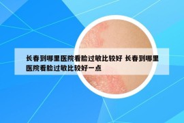 長春到哪里醫(yī)院看臉過敏比較好 長春到哪里醫(yī)院看臉過敏比較好一點(diǎn)