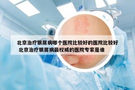 北京治療銀屑病哪個醫(yī)院比較好的醫(yī)院比較好 北京治療銀屑病最權威的醫(yī)院專家是誰