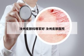 汝州皮膚科哪家好 汝州皮膚醫(yī)院