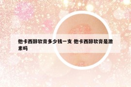 他卡西醇軟膏多少錢一支 他卡西醇軟膏是激素嗎