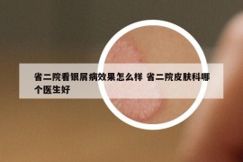 省二院看銀屑病效果怎么樣 省二院皮膚科哪個(gè)醫(yī)生好
