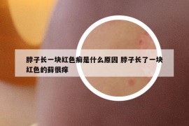 脖子長一塊紅色癬是什么原因 脖子長了一塊紅色的蘚很癢