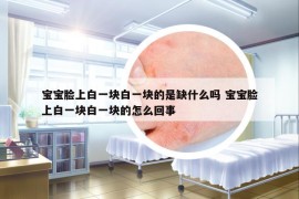 寶寶臉上白一塊白一塊的是缺什么嗎 寶寶臉上白一塊白一塊的怎么回事