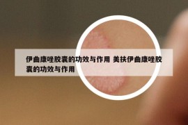 伊曲康唑膠囊的功效與作用 美扶伊曲康唑膠囊的功效與作用