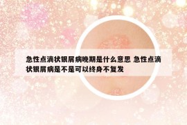 急性點滴狀銀屑病晚期是什么意思 急性點滴狀銀屑病是不是可以終身不復發(fā)