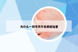 為什么一到冬天牛皮癬就加重