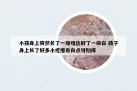 小孩身上突然長了一堆嘎達好了一塊白 孩子身上長了好多小疙瘩有白點特別癢