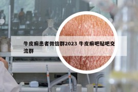 牛皮癬患者微信群2023 牛皮癬吧貼吧交流群
