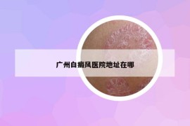 廣州白癜風(fēng)醫(yī)院地址在哪
