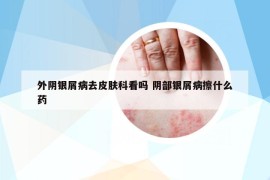 外陰銀屑病去皮膚科看嗎 陰部銀屑病擦什么藥