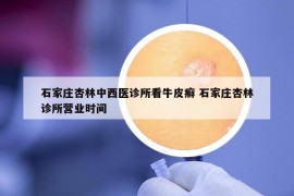 石家莊杏林中西醫(yī)診所看牛皮癬 石家莊杏林診所營業(yè)時間