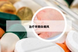 治療早期白癜風