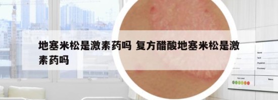 地塞米松是激素藥嗎 復(fù)方醋酸地塞米松是激素藥嗎