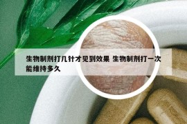 生物制劑打幾針才見到效果 生物制劑打一次能維持多久