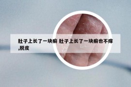 肚子上長了一塊癬 肚子上長了一塊癬也不癢,脫皮