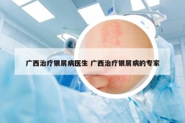 廣西治療銀屑病醫(yī)生 廣西治療銀屑病的專家