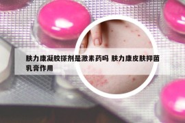 膚力康凝膠搽劑是激素藥嗎 膚力康皮膚抑菌乳膏作用