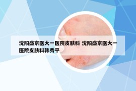 沈陽盛京醫(yī)大一醫(yī)院皮膚科 沈陽盛京醫(yī)大一醫(yī)院皮膚科韓秀平