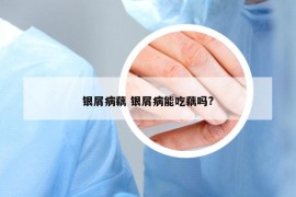 銀屑病藕 銀屑病能吃藕嗎?