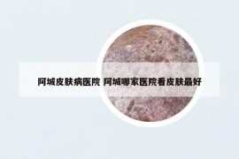 阿城皮膚病醫(yī)院 阿城哪家醫(yī)院看皮膚最好
