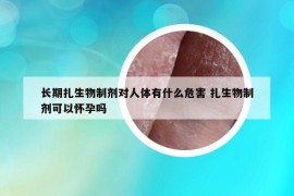 長期扎生物制劑對人體有什么危害 扎生物制劑可以懷孕嗎