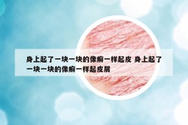 身上起了一塊一塊的像癬一樣起皮 身上起了一塊一塊的像癬一樣起皮屑