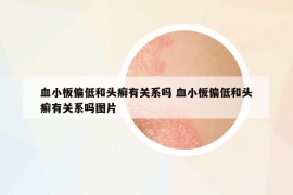 血小板偏低和頭癬有關(guān)系嗎 血小板偏低和頭癬有關(guān)系嗎圖片