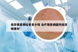 南京銀屑病檢查多少錢 治療銀屑病醫(yī)院南京哪里好