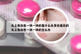 頭上有白色一塊一塊的是什么頭發(fā)也是白的 頭上有白色一塊一塊的怎么辦
