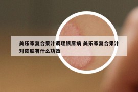 美樂家復(fù)合果汁調(diào)理銀屑病 美樂家復(fù)合果汁對(duì)皮膚有什么功效